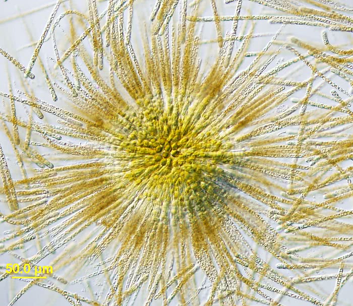 Cyanobacteria  Gloeotrichia echinulata