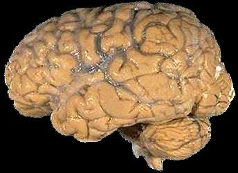 brain photo
