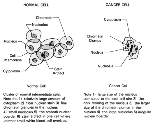 normal and cancer cells
