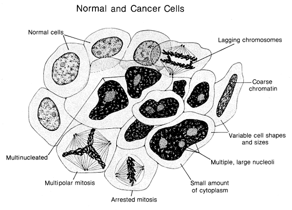normal and cancerous cells