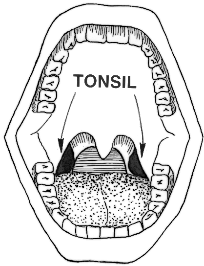 tonsil