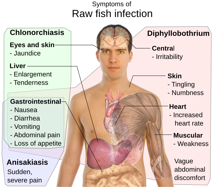 raw fish infection symptoms