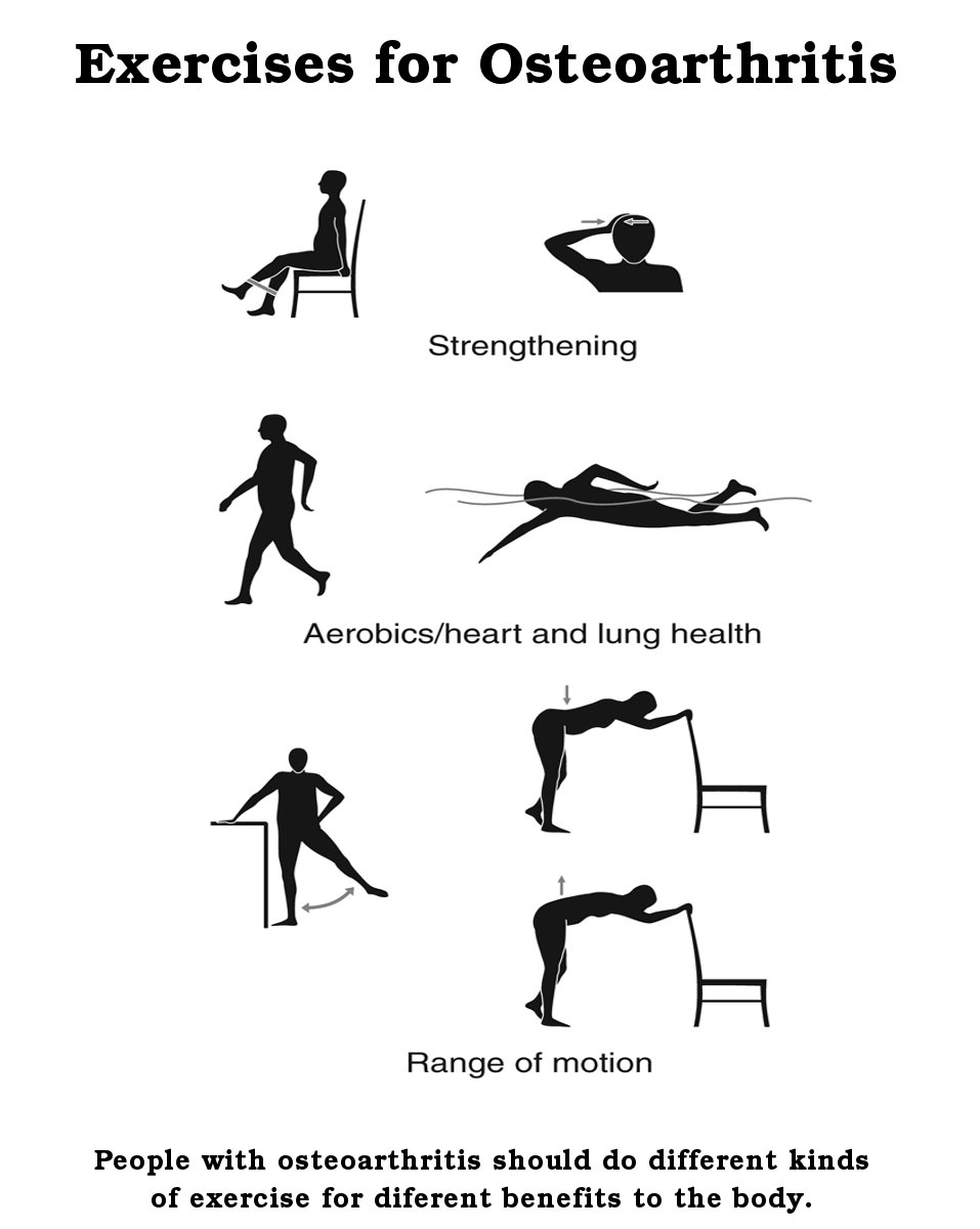 Osteoarthritis exercises