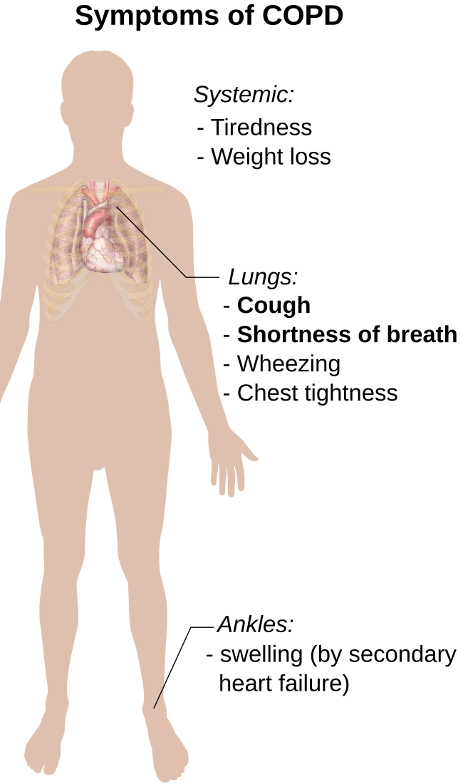 Symptoms of COPD