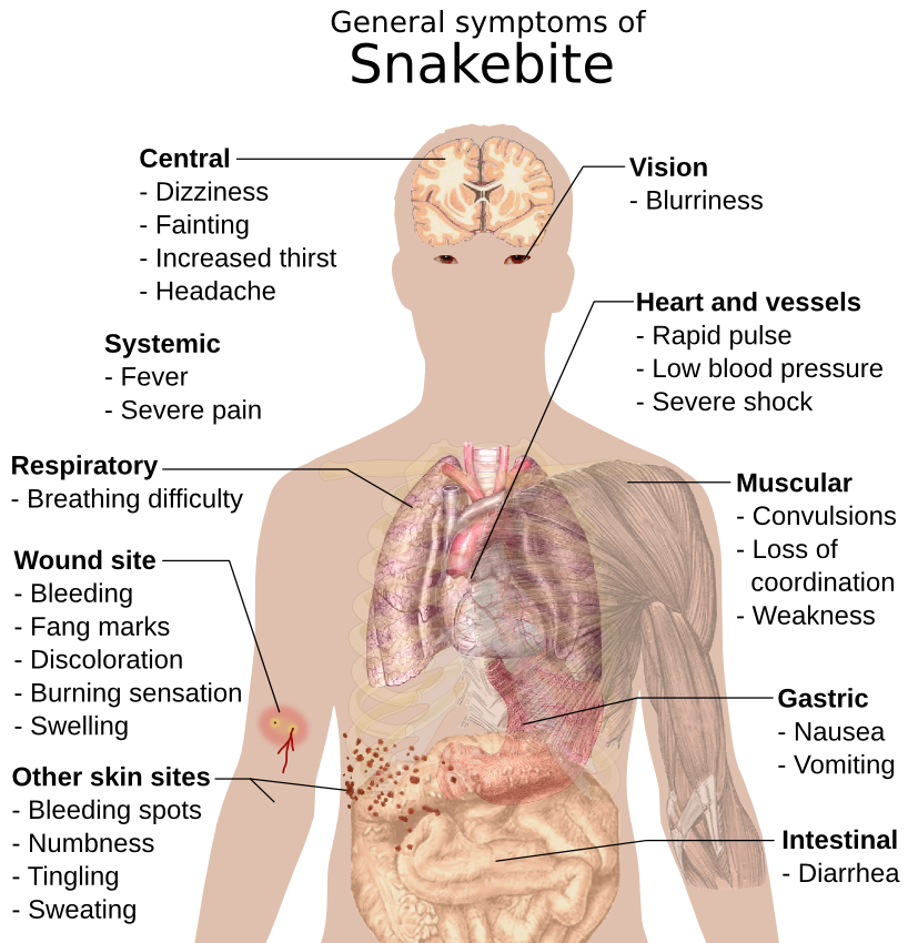 Snake bite symptoms