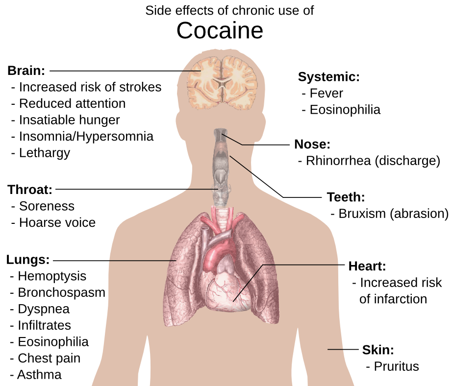 Cocaine side effects