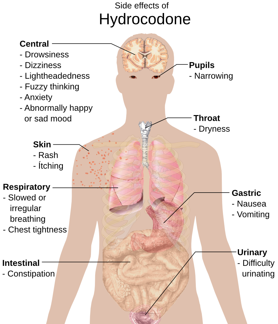 Hydrocodone side effects