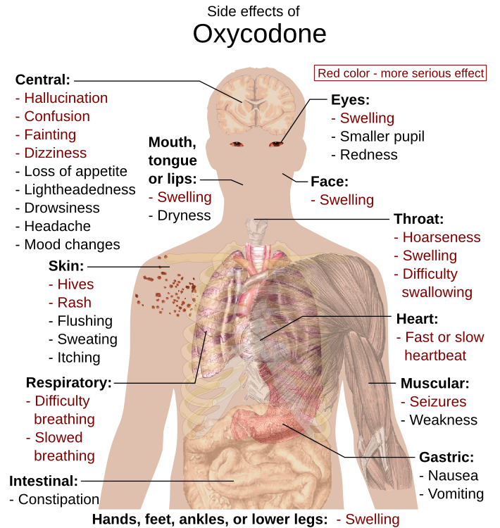 Oxycodone side effects