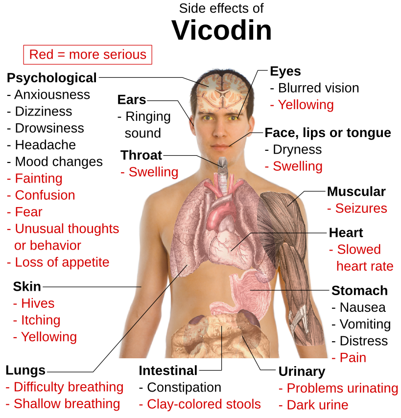 Vicodin side effects