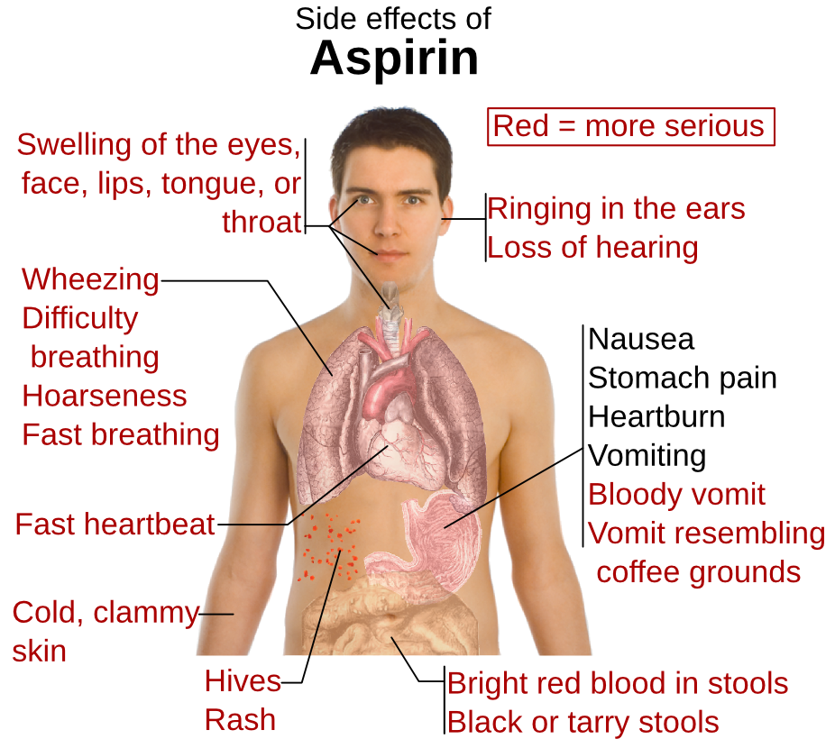 aspirin side effects