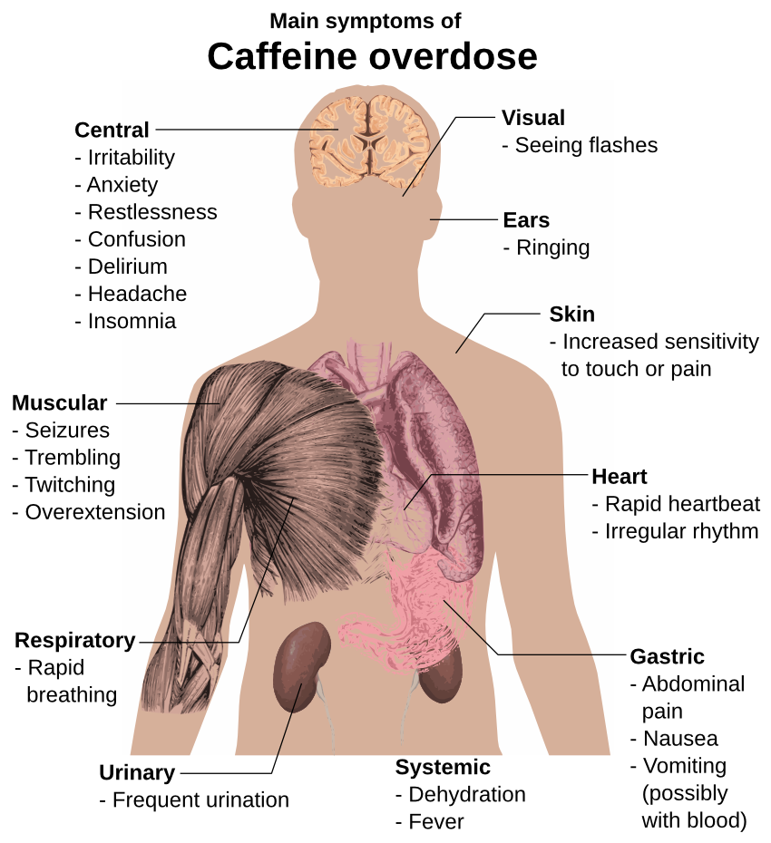 Caffeine overdose symptoms