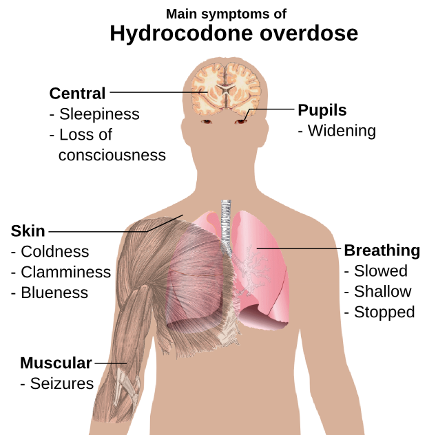hydrocodone overdose symptoms