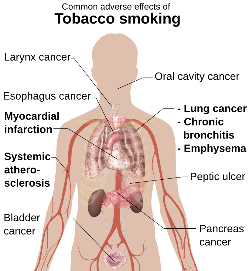 tobacco smoking adverse effects