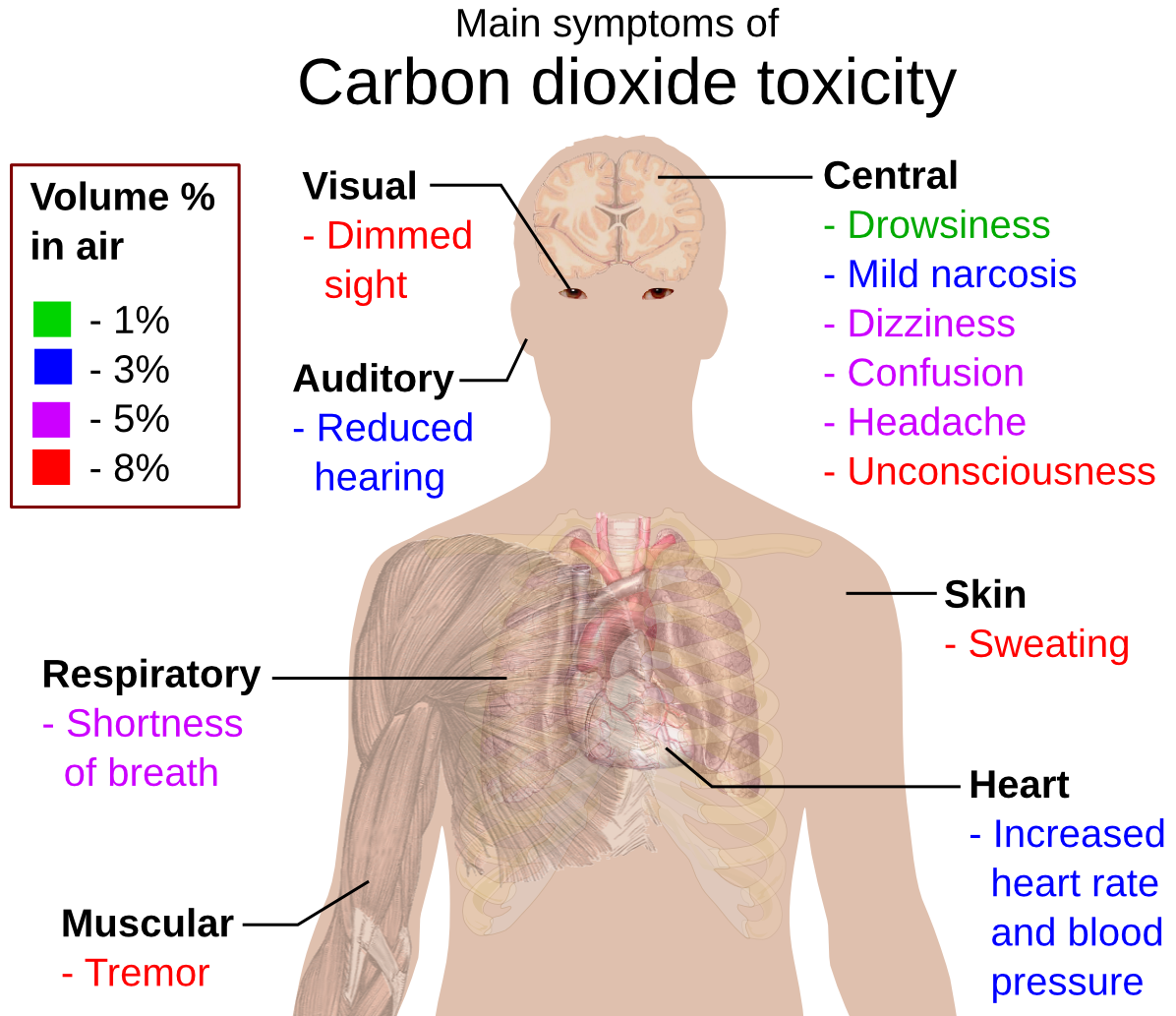 carbon dioxide toxicity
