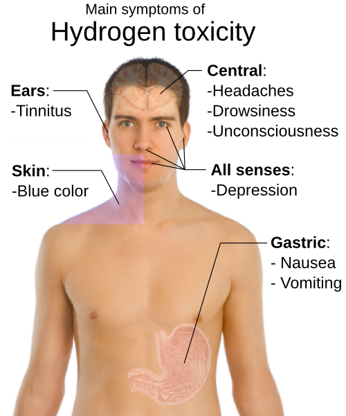 hydrogen toxicity