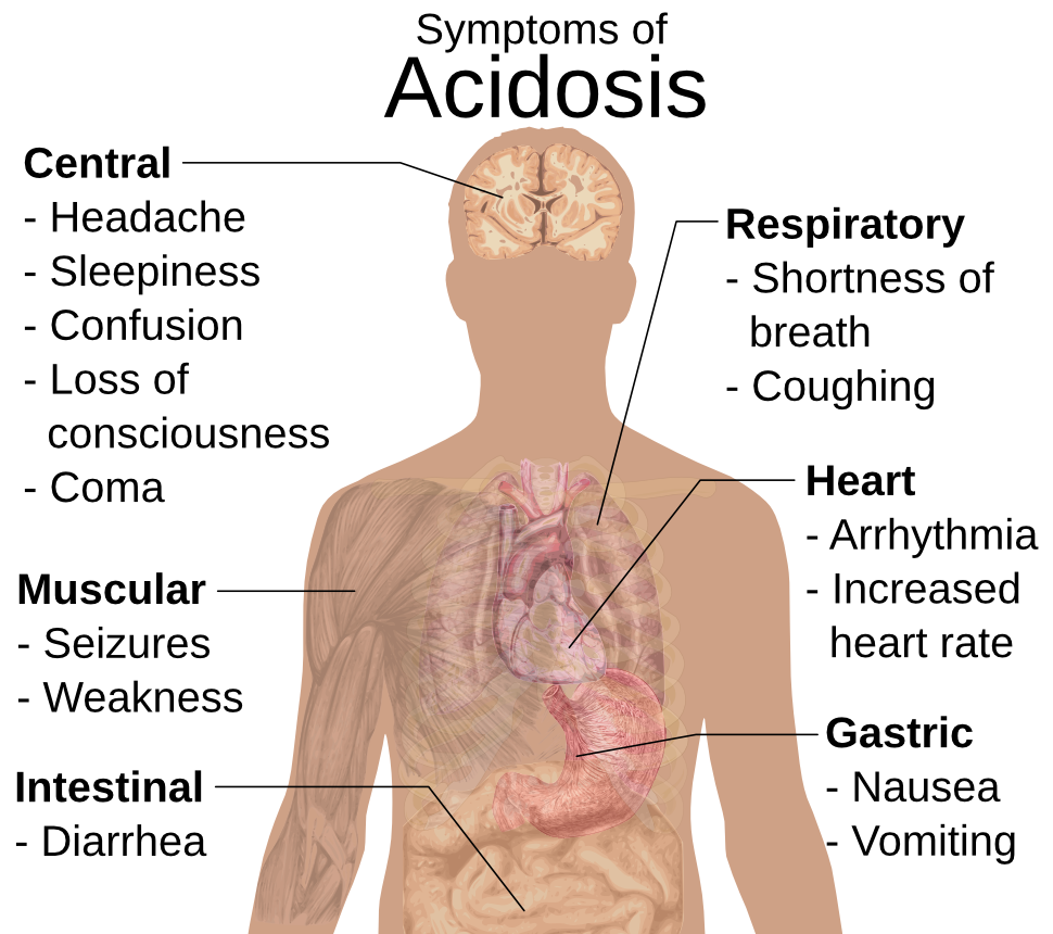 acidosis symptoms