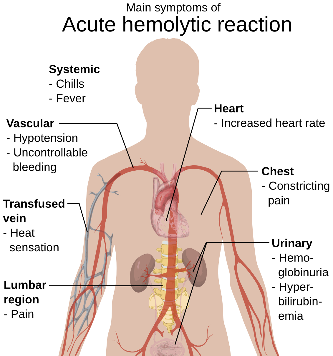 hemolytic reaction