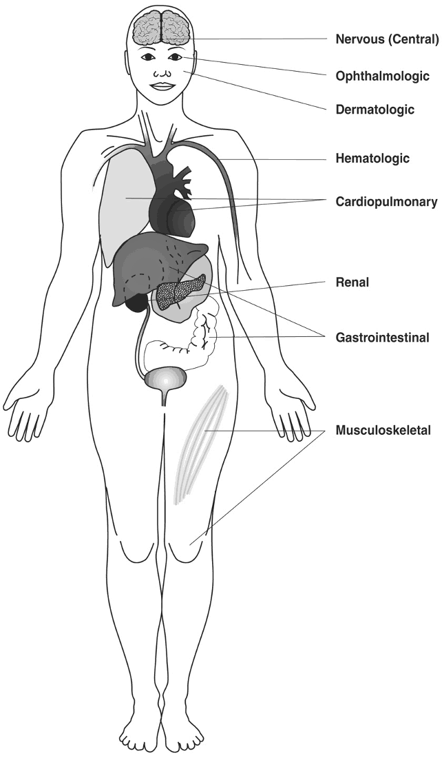 Lupus potential systems affected