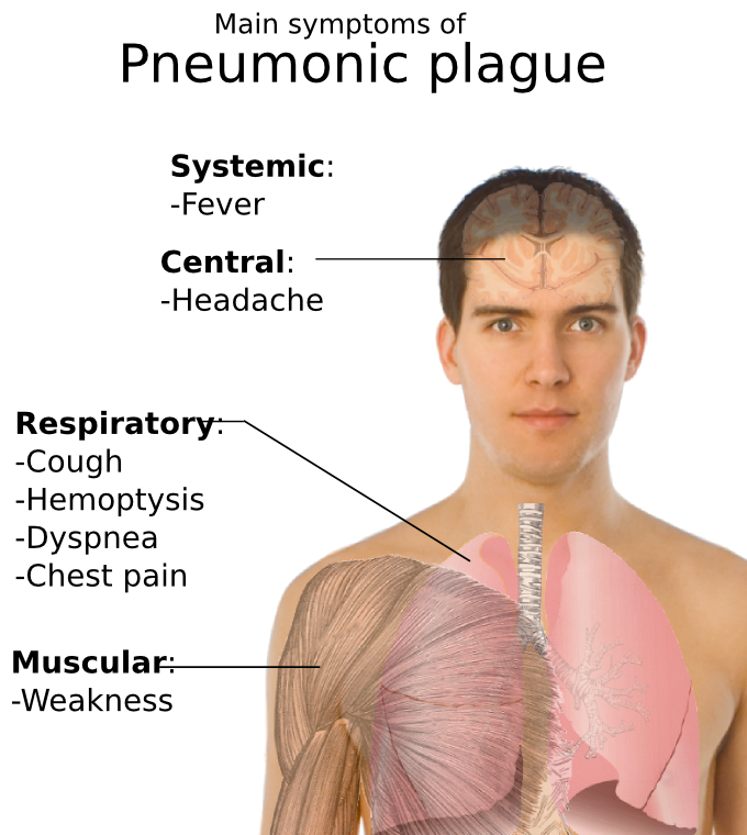 pneumonic plague symptoms