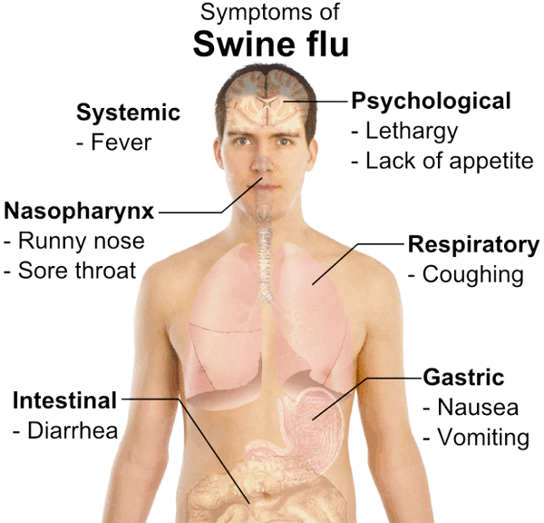 Symptoms of swine flu