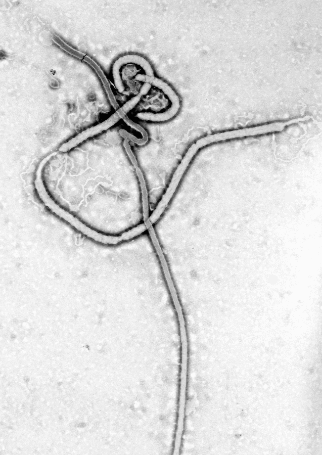 Ebola virus BW