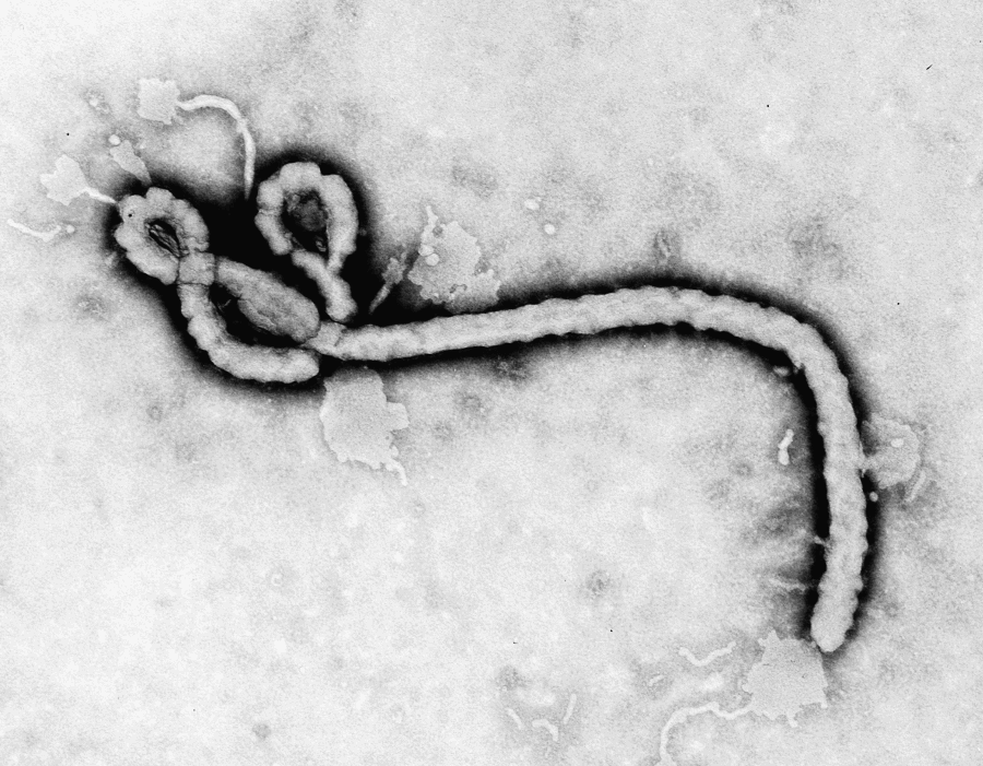 ebola first photo 1976