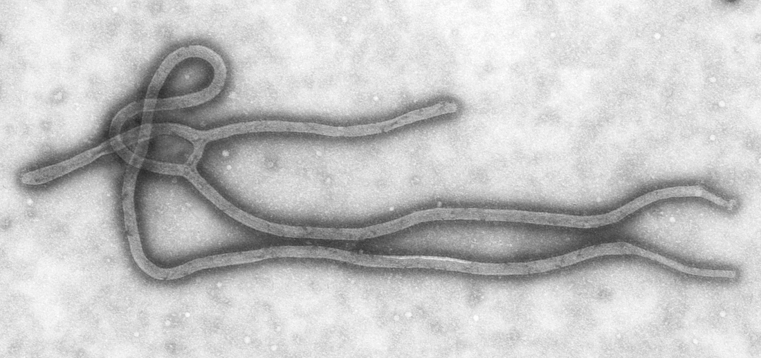ebola large BW