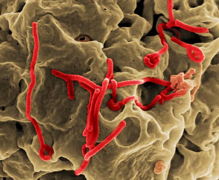 ebola virus color enhanced