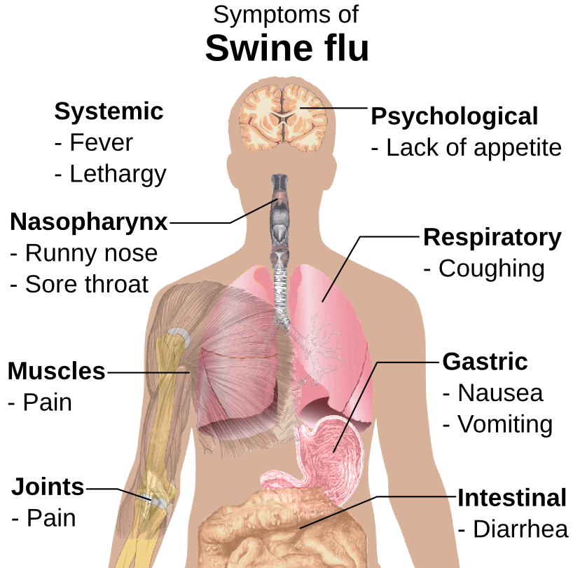 swine flu symptoms
