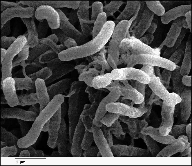 Cholera bacteria BW