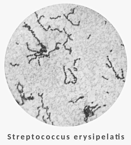 Streptococcus erysipelatis