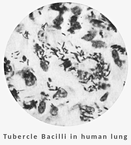 Tubercle Bacilli