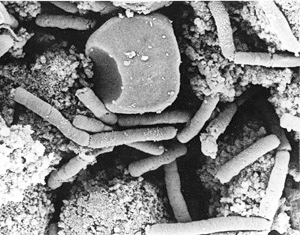 anthrax Bacteria