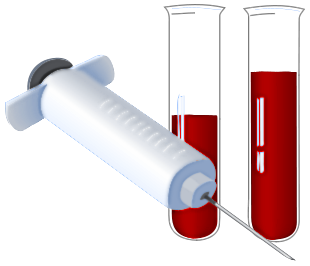 test tubes with syringe