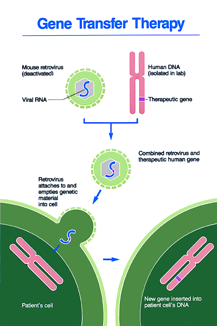 gene trasnsfer therapy