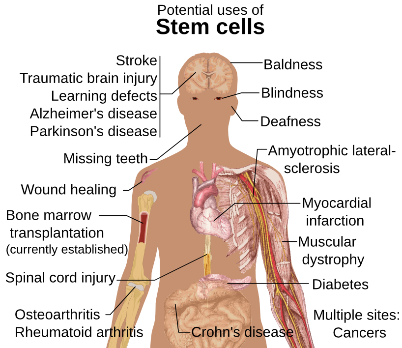 Stem cell treatments