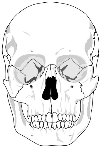 Human skull 2